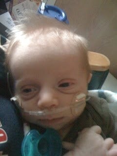 RSV Awareness, Symptoms, and Tips