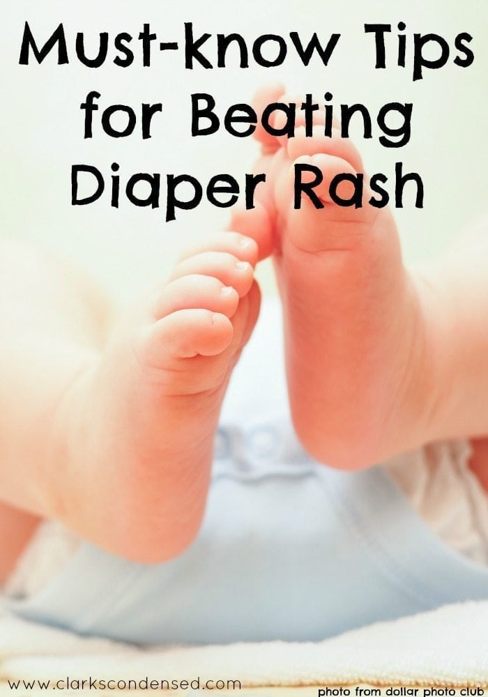 Tips for Preventing and Treating Diaper Rash